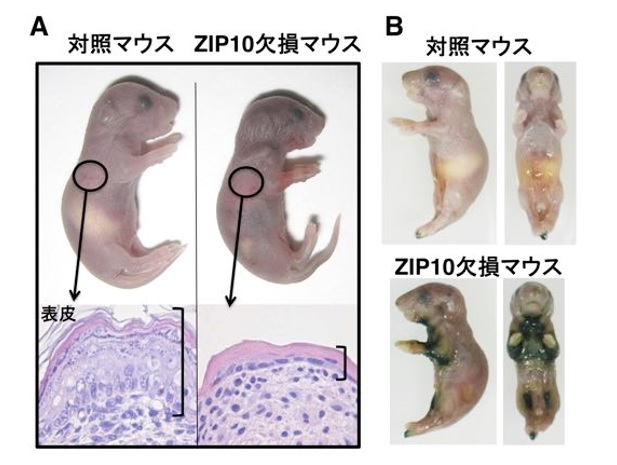 徳島文理大学薬学部の深田俊幸教授らが、アトピー性皮膚炎に関わる新たな分子を発見 ～体内の亜鉛を運搬するZIP10が関与することを世界で初めて明らかに
